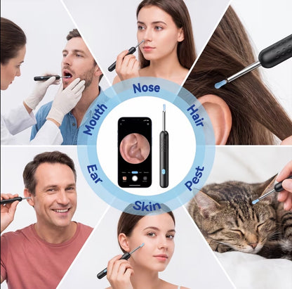 Ear Wax Removal Kit